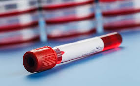 manufacturing of blood collection tubes